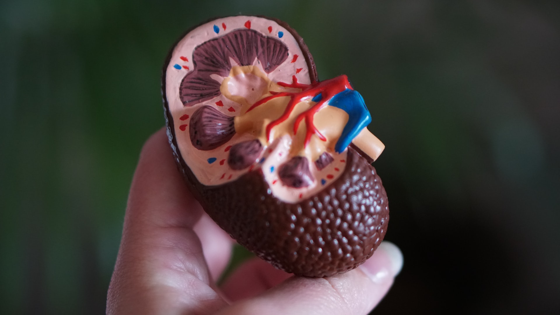 A model of kidney